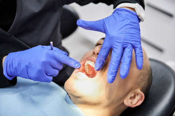 Best After-Hours Emergency Dentist in Mcelhattan, PA